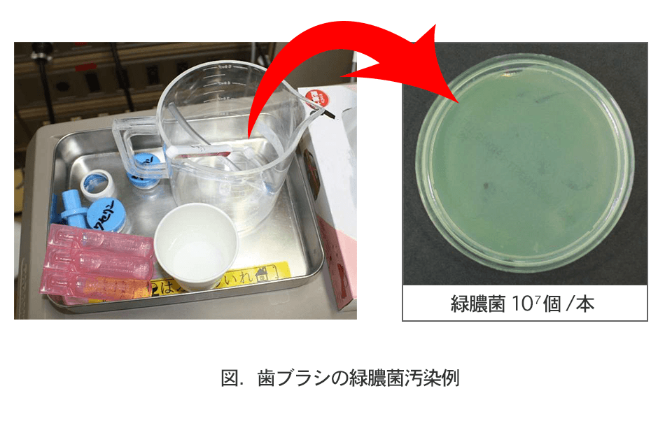 歯ブラシの緑膿菌汚染例